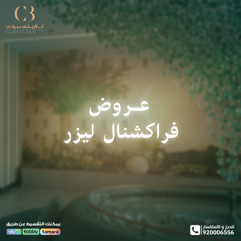 عروض فراكشنال ليزر في يوم التأسيس