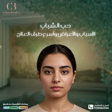 حب الشباب: الأسباب والأعراض وأسرع طرق العلاج