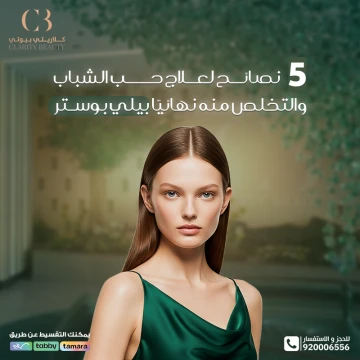 5 نصائح لعلاج حب الشباب والتخلص منه نهائيًا