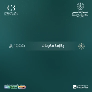 بلازما ماجلان